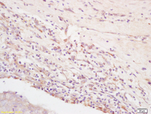 Integrin Alpha V + Beta 3 Antibody in Immunohistochemistry (Paraffin) (IHC (P))