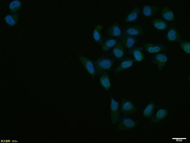 Lamin A/C Antibody in Immunocytochemistry (ICC/IF)