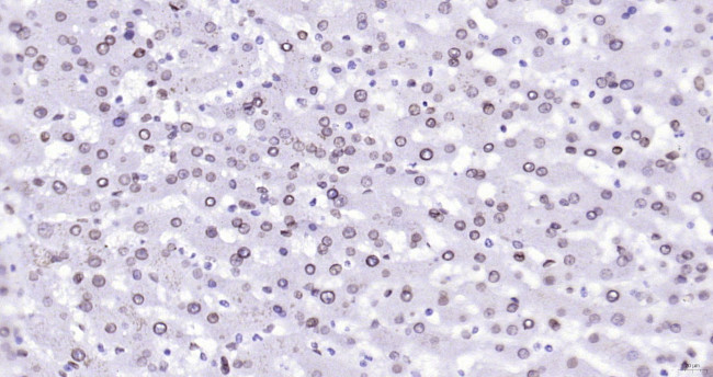 Lamin A/C Antibody in Immunohistochemistry (Paraffin) (IHC (P))