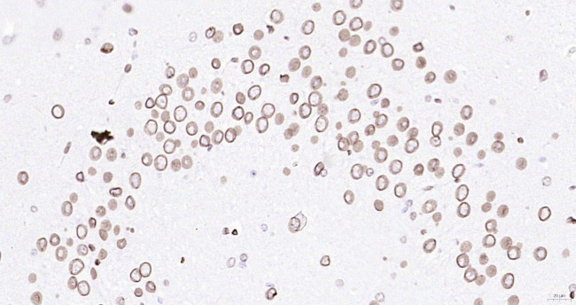 Lamin A/C Antibody in Immunohistochemistry (Paraffin) (IHC (P))