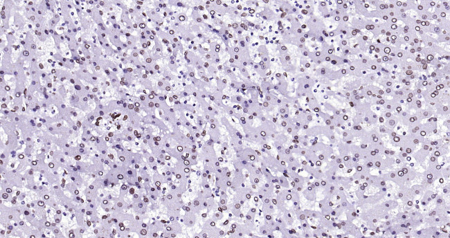 Lamin A/C Antibody in Immunohistochemistry (Paraffin) (IHC (P))