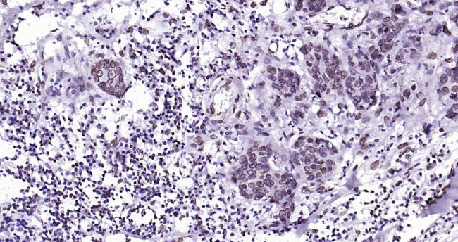 Lamin A/C Antibody in Immunohistochemistry (Paraffin) (IHC (P))