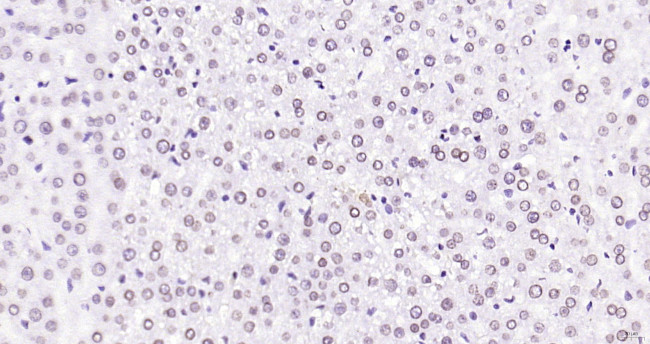 Lamin A/C Antibody in Immunohistochemistry (Paraffin) (IHC (P))