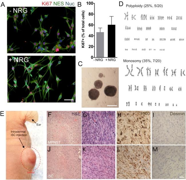 Ki-67 Antibody in Immunocytochemistry (ICC/IF)