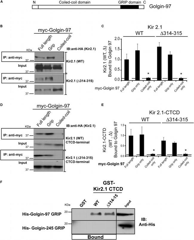 Golgin-97 Antibody in Immunoprecipitation (IP)