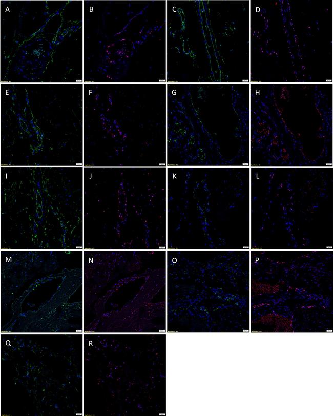 SOX2 Antibody in Immunohistochemistry (IHC)