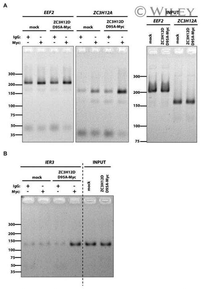 c-Myc Antibody in Immunoprecipitation (IP)