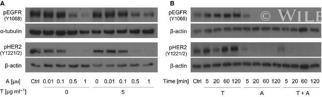 Phospho-EGFR (Tyr1068) Antibody in Western Blot (WB)