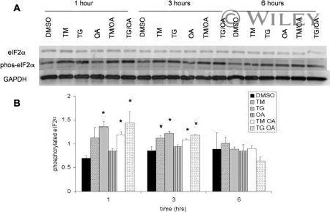 GAPDH Antibody in Western Blot (WB)