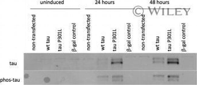 Phospho-Tau (Ser199, Ser202) Antibody in Western Blot (WB)