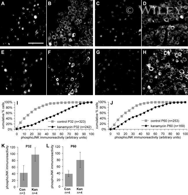 Phospho-JNK1/JNK2 (Thr183, Tyr185) Antibody in Immunohistochemistry (IHC)