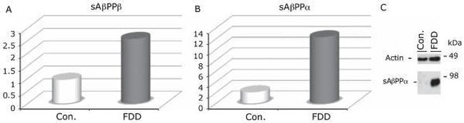 beta Amyloid Antibody in ELISA (ELISA)