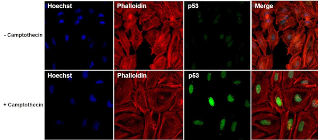 p53 Antibody in Immunocytochemistry (ICC/IF)