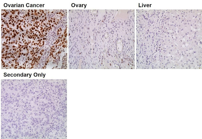 p53 Antibody in Immunohistochemistry (Paraffin) (IHC (P))