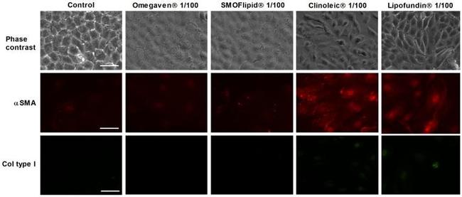 Collagen I Antibody in Immunocytochemistry (ICC/IF)