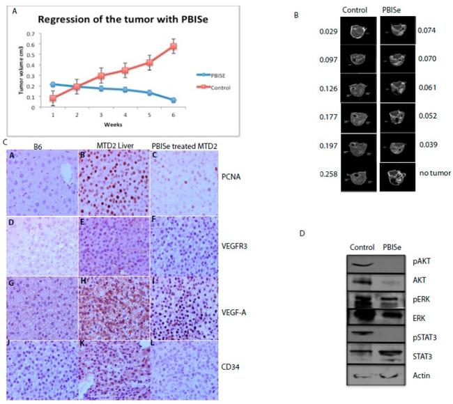 VEGF Receptor 3 Antibody in Immunohistochemistry (IHC)