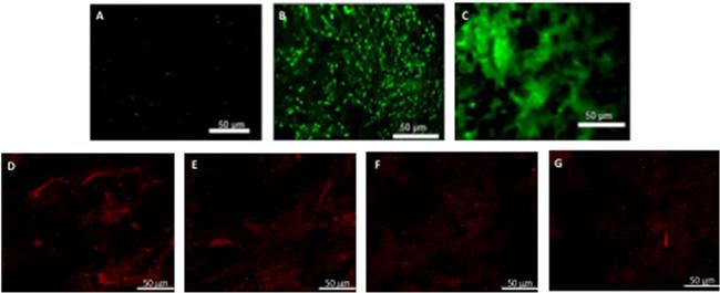 Alpha-Smooth Muscle Actin Antibody in Immunocytochemistry (ICC/IF)