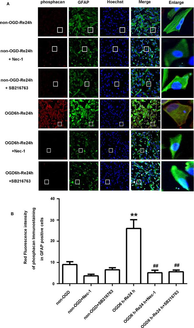 GFAP Antibody in Immunocytochemistry (ICC/IF)