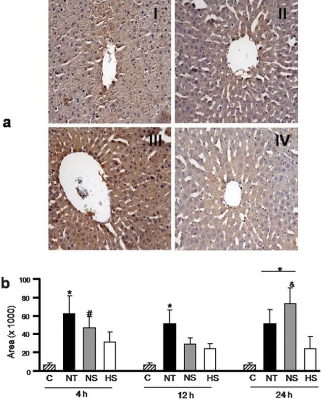 Nitrotyrosine Antibody in Immunohistochemistry (IHC)