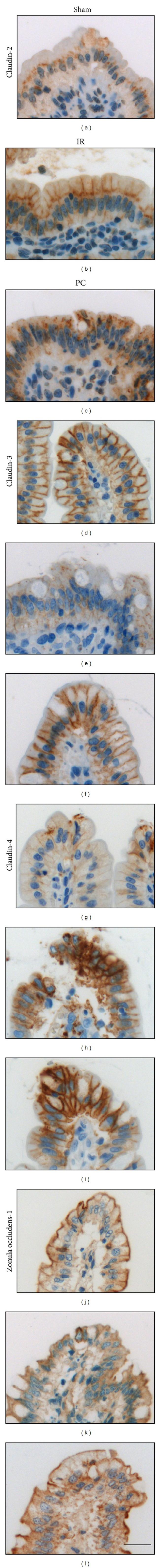 Claudin 2 Antibody in Immunohistochemistry, Immunohistochemistry (Paraffin) (IHC, IHC (P))