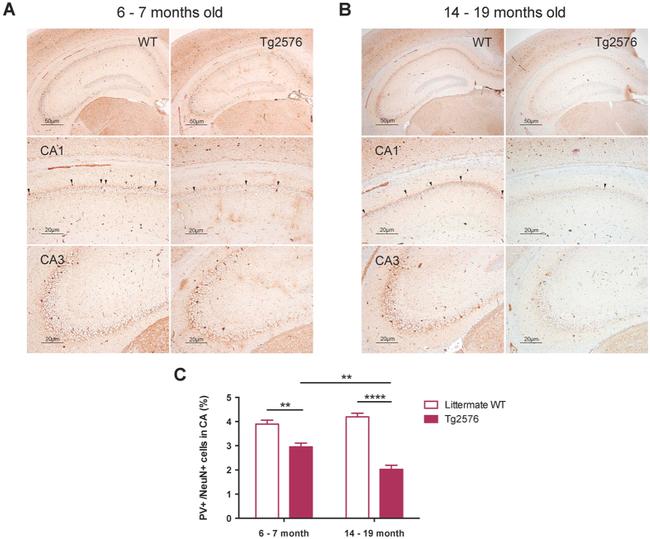 Parvalbumin Antibody in Immunohistochemistry, Immunohistochemistry (Paraffin) (IHC, IHC (P))