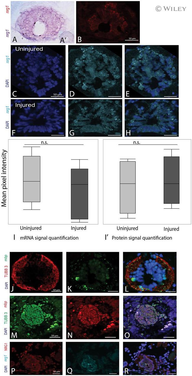 beta-3 Tubulin Antibody in Immunohistochemistry (IHC)