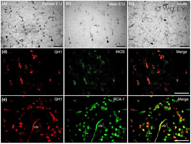 iNOS Antibody in Immunocytochemistry (ICC/IF)