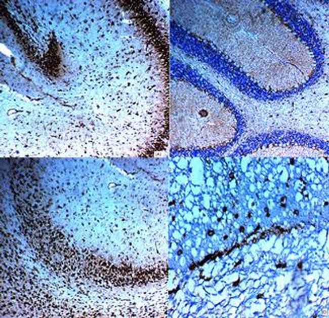 Caspase 3 Antibody in Immunohistochemistry (IHC)