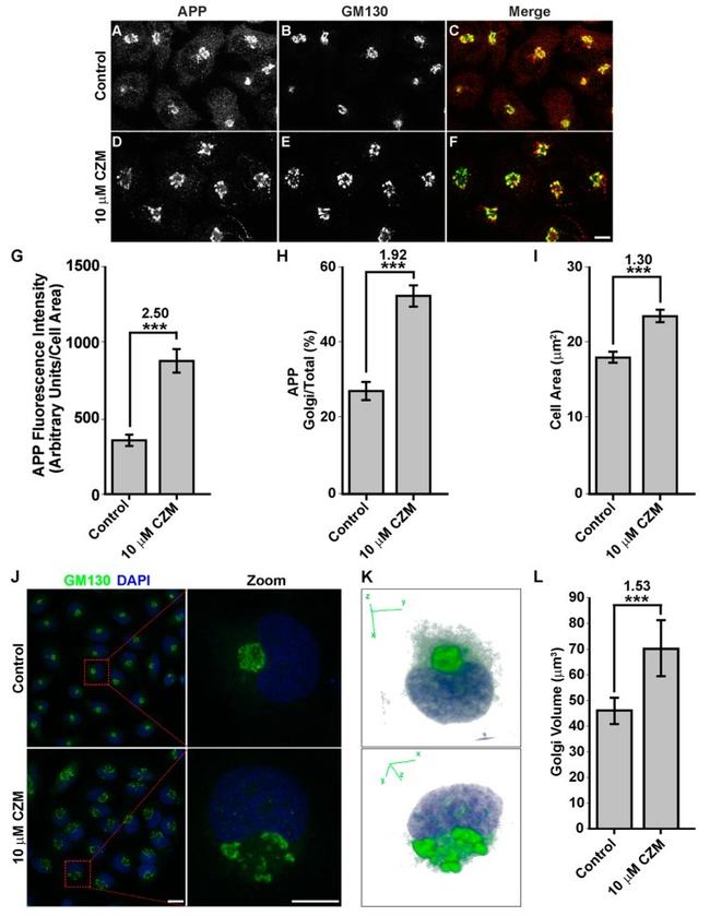 beta Amyloid Antibody in Immunocytochemistry (ICC/IF)