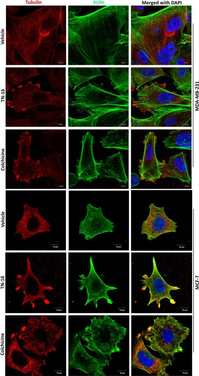 beta Tubulin Antibody in Immunocytochemistry (ICC/IF)