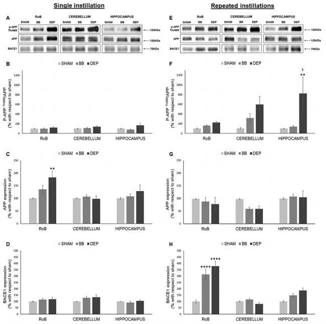 beta Amyloid Antibody in Western Blot (WB)