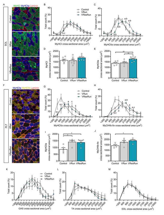 Laminin Antibody in Immunohistochemistry (IHC)