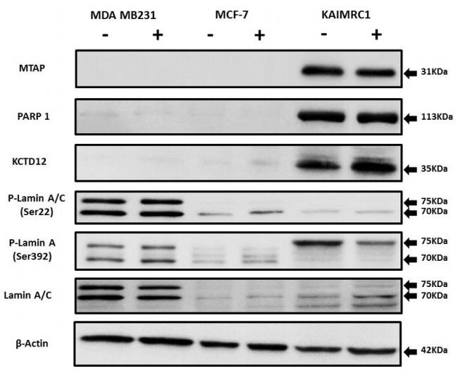 Phospho-Lamin A/C (Ser22) Antibody in Western Blot (WB)