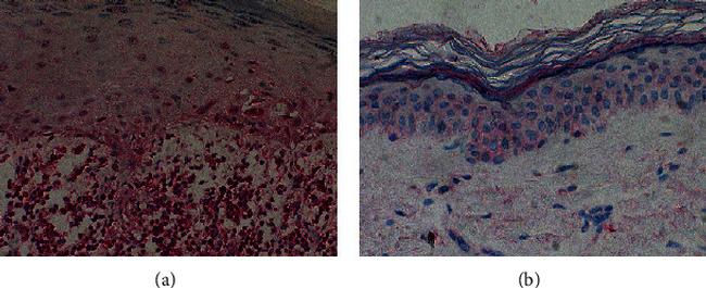 IL-17A Antibody in Immunohistochemistry (IHC)