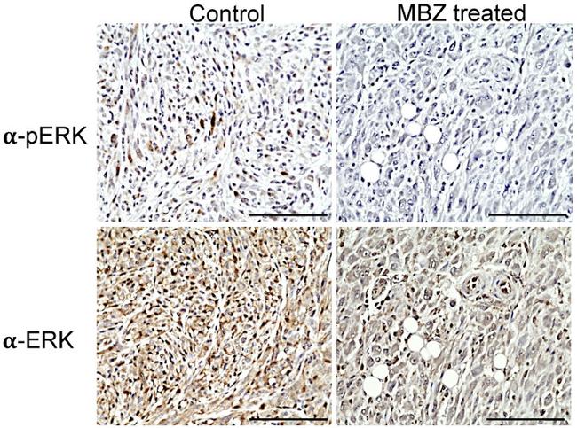 Phospho-ERK1/ERK2 (Thr202, Tyr204) Antibody in Immunohistochemistry (IHC)