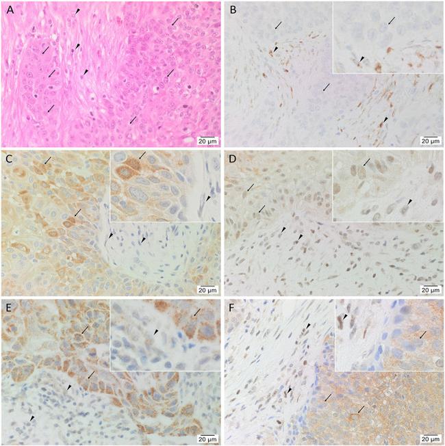 SOX2 Antibody in Immunohistochemistry (IHC)