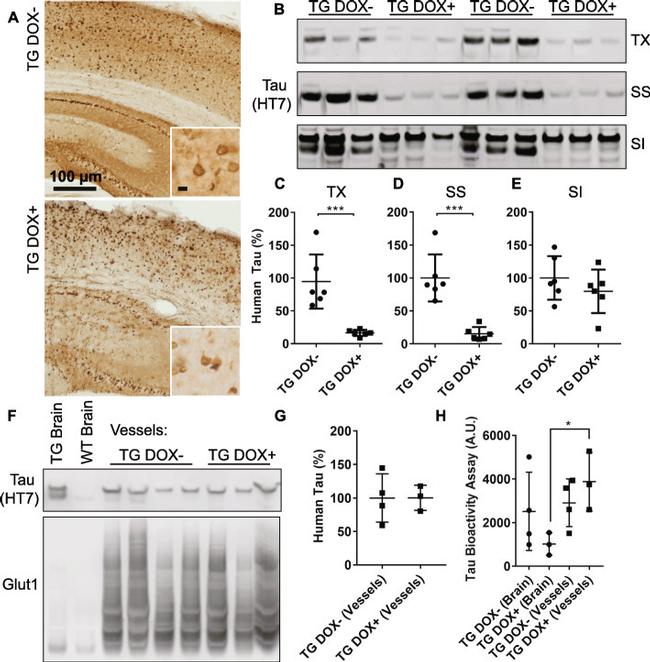 Tau Antibody in Western Blot (WB)