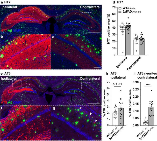 Tau Antibody in Immunohistochemistry (IHC)