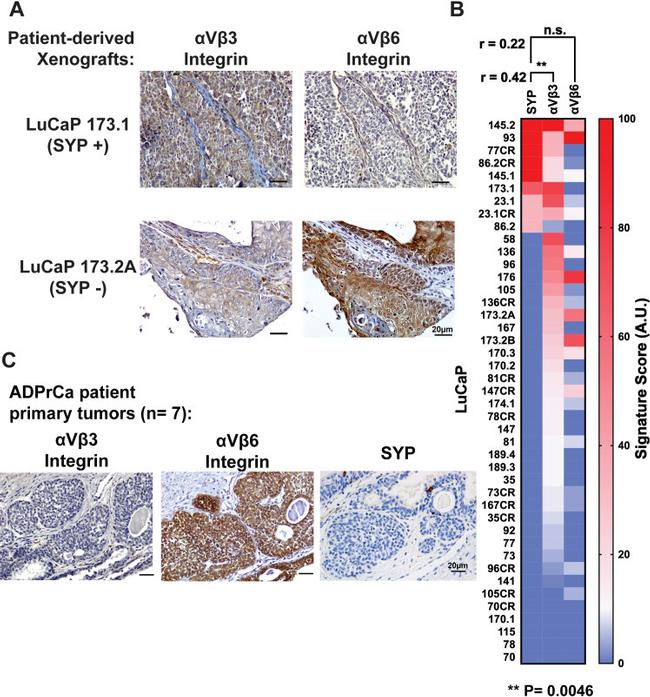 Synaptophysin Antibody in Immunohistochemistry (IHC)