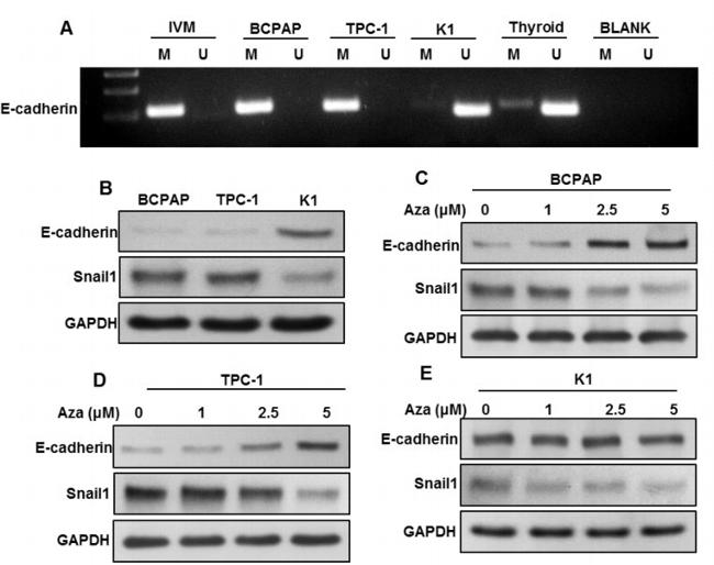 SNAIL Antibody in Western Blot (WB)