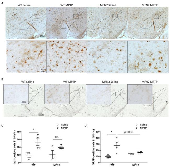 GFAP Antibody in Immunohistochemistry (IHC)