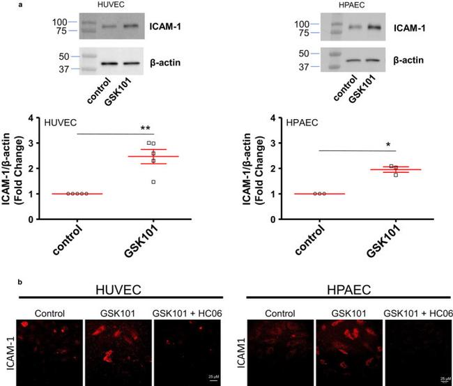 ICAM-1 Antibody in Immunocytochemistry (ICC/IF)