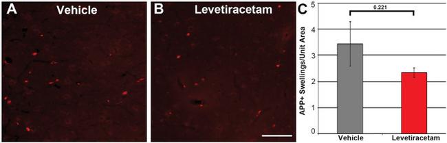 beta Amyloid Antibody in Immunohistochemistry (IHC)