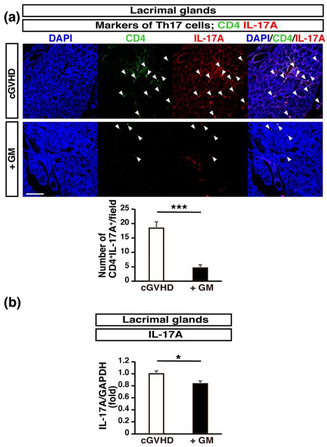 IL-17A Antibody in Immunohistochemistry (IHC)