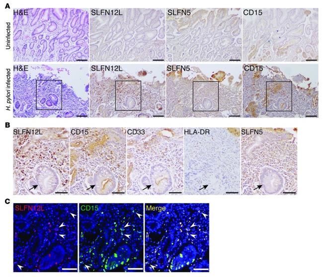 CD15 Antibody in Immunocytochemistry, Immunohistochemistry (ICC/IF, IHC)