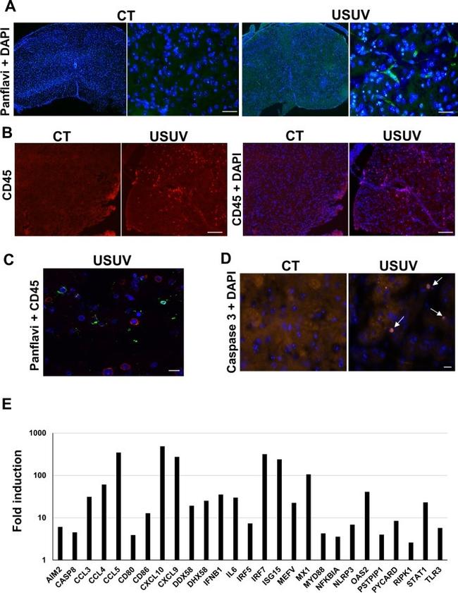 CD45 Antibody in Immunohistochemistry (IHC)