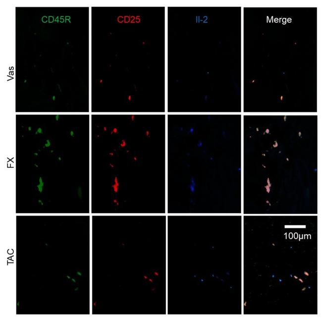 CD45R (B220) Antibody in Immunohistochemistry (IHC)