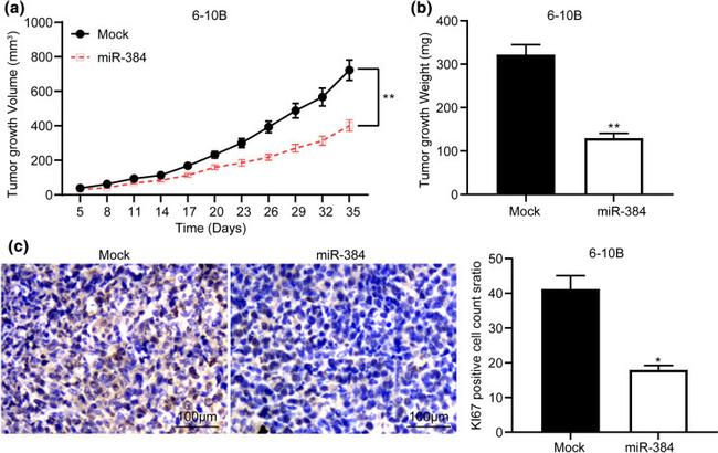 Ki-67 Antibody in Immunohistochemistry (IHC)