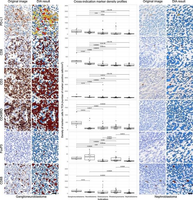 FOXP3 Antibody in Immunohistochemistry (IHC)