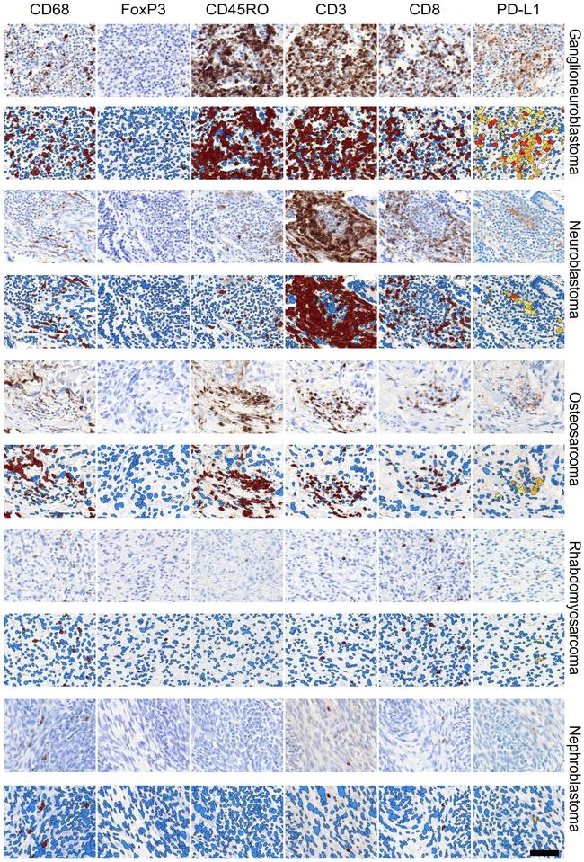 FOXP3 Antibody in Immunohistochemistry (IHC)